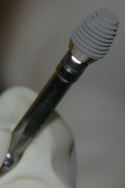 Къс имплант