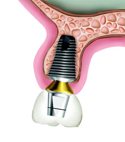 ���������� �� ����� ������