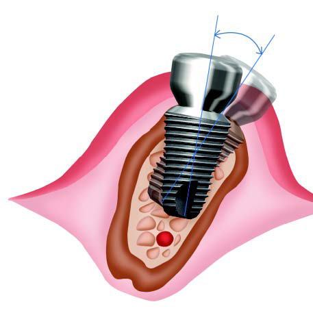 ���������� �� ����� ������